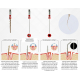 Endo Extractor System (vyťahovač zalomených endo nástrojov)